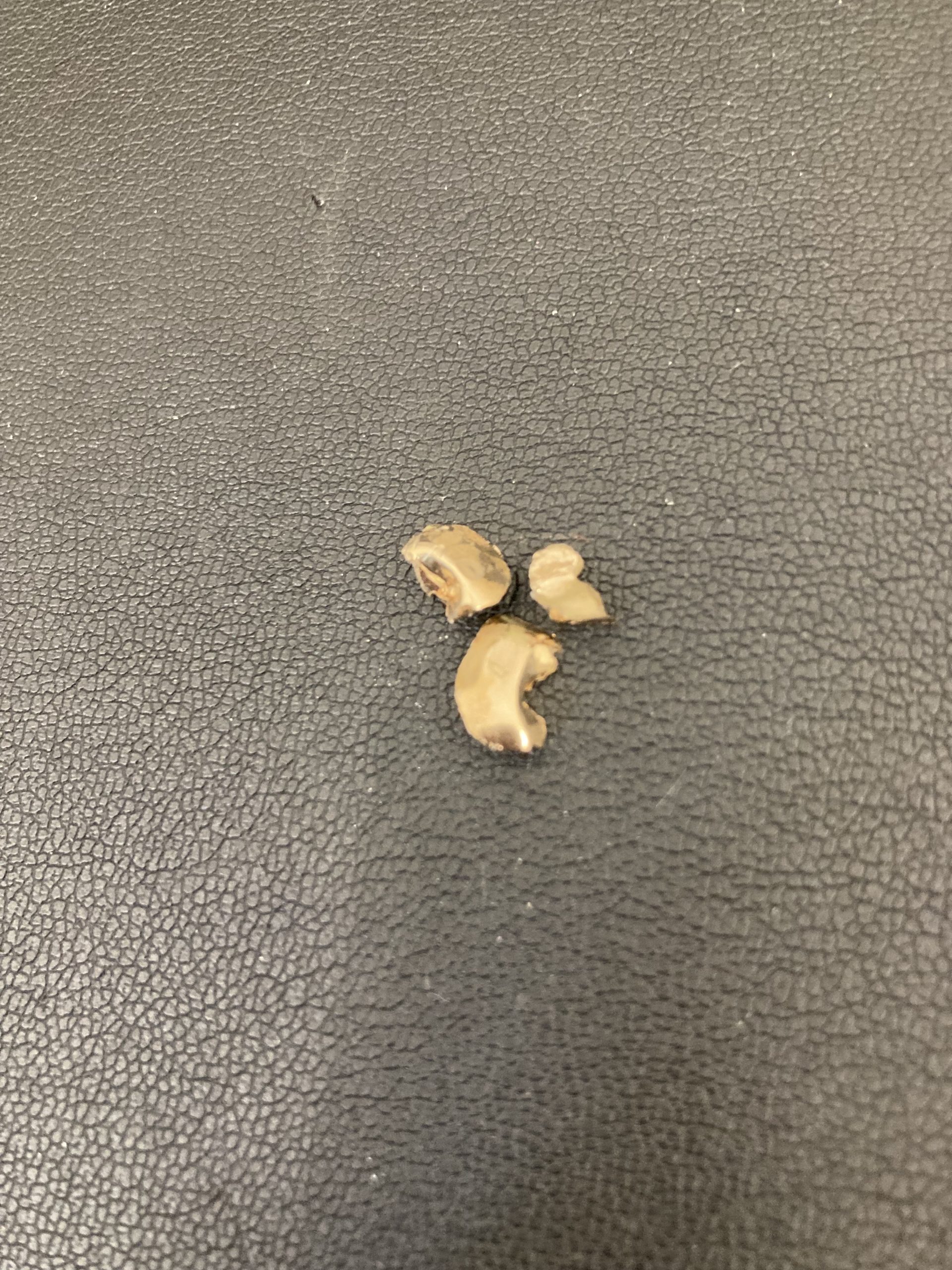 金歯は捨てないでください！＾＾！