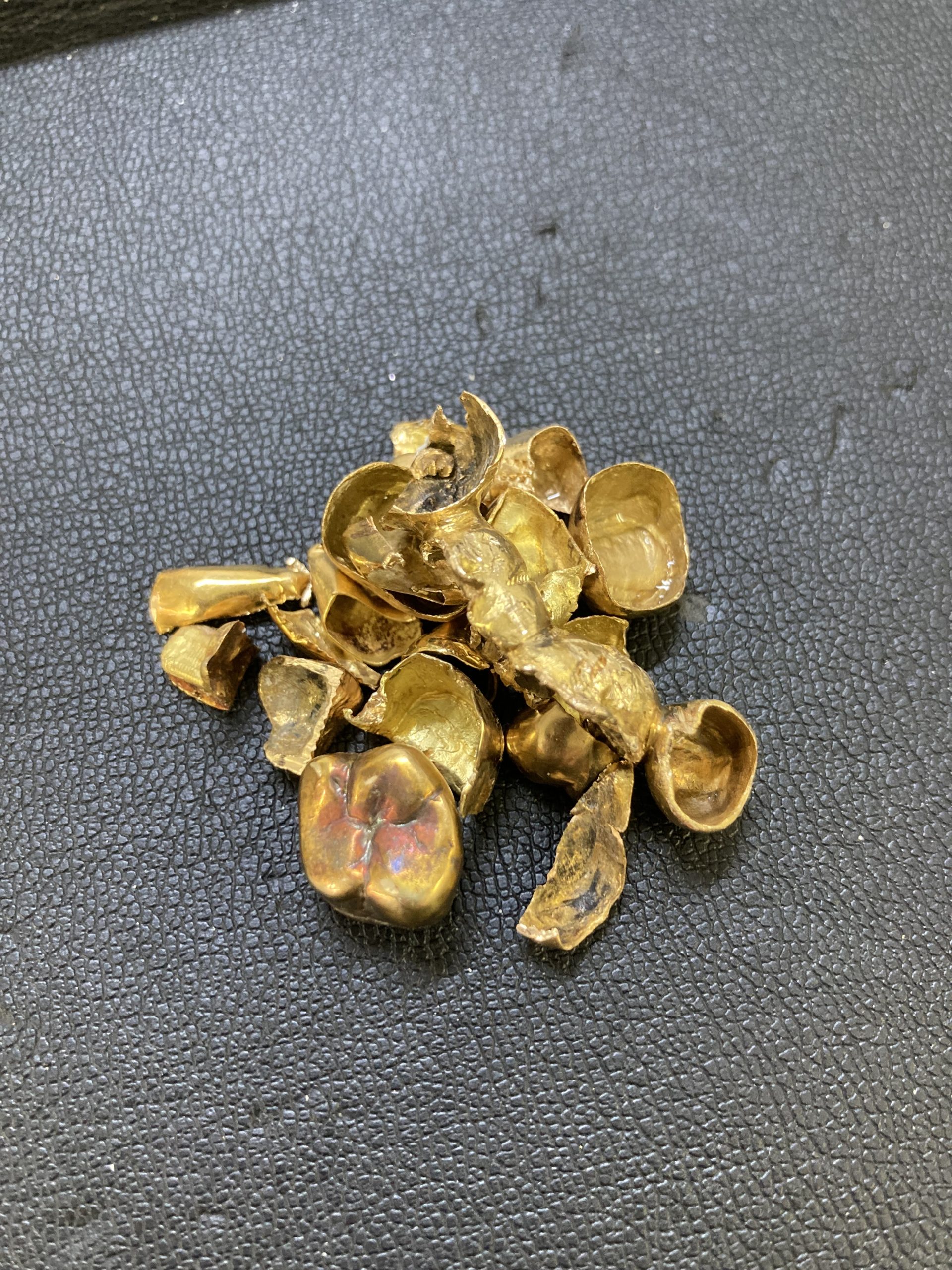 金歯はお買取りできます＾＾